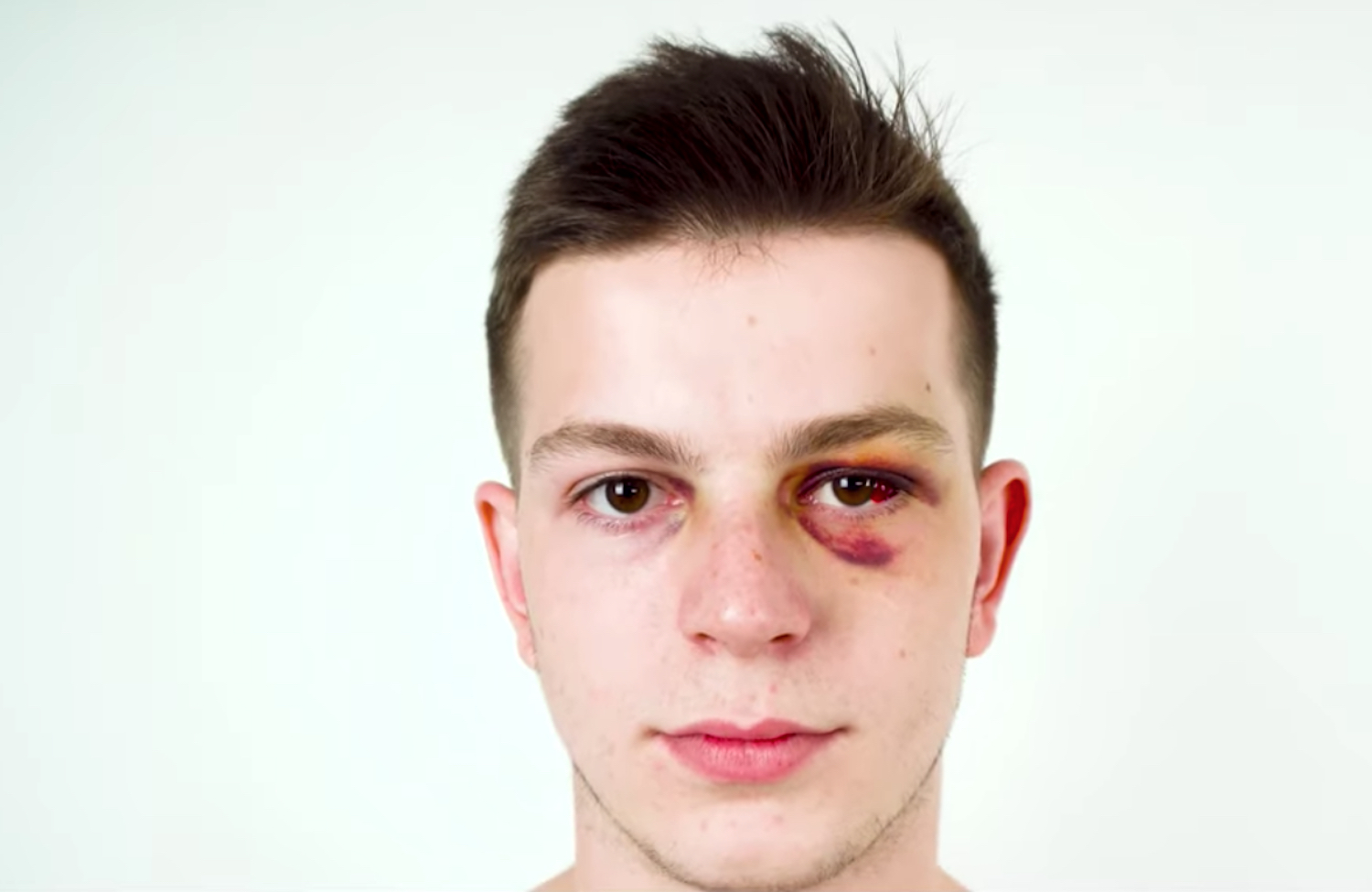Ecco i manifestanti pestati dalla polizia in Bielorussia, le immagini che sbugiardano il governo – Video