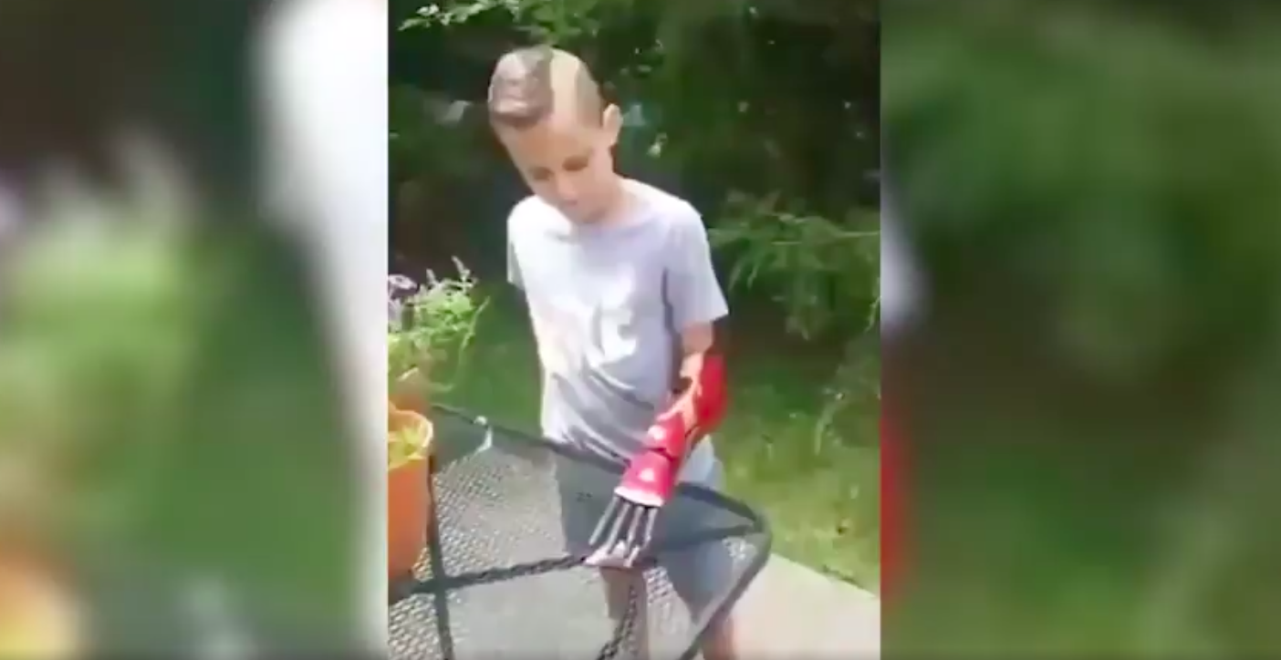 Il ragazzino dell’Ohio con il braccio di IronMan – Il video