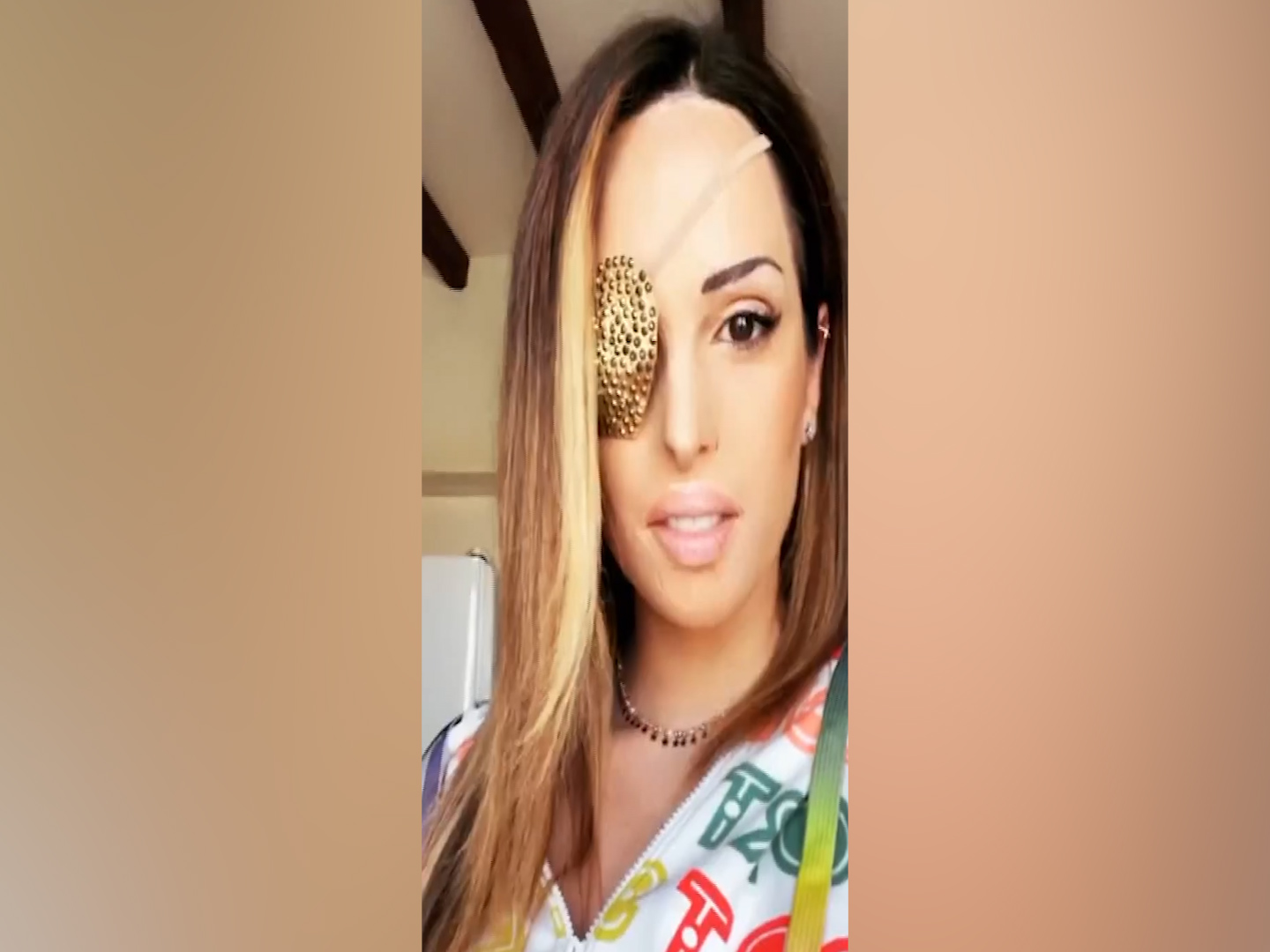 «Tanta sofferenza ma ne è valsa la pena», Gessica Notaro mostra il viso dopo gli interventi – Il video
