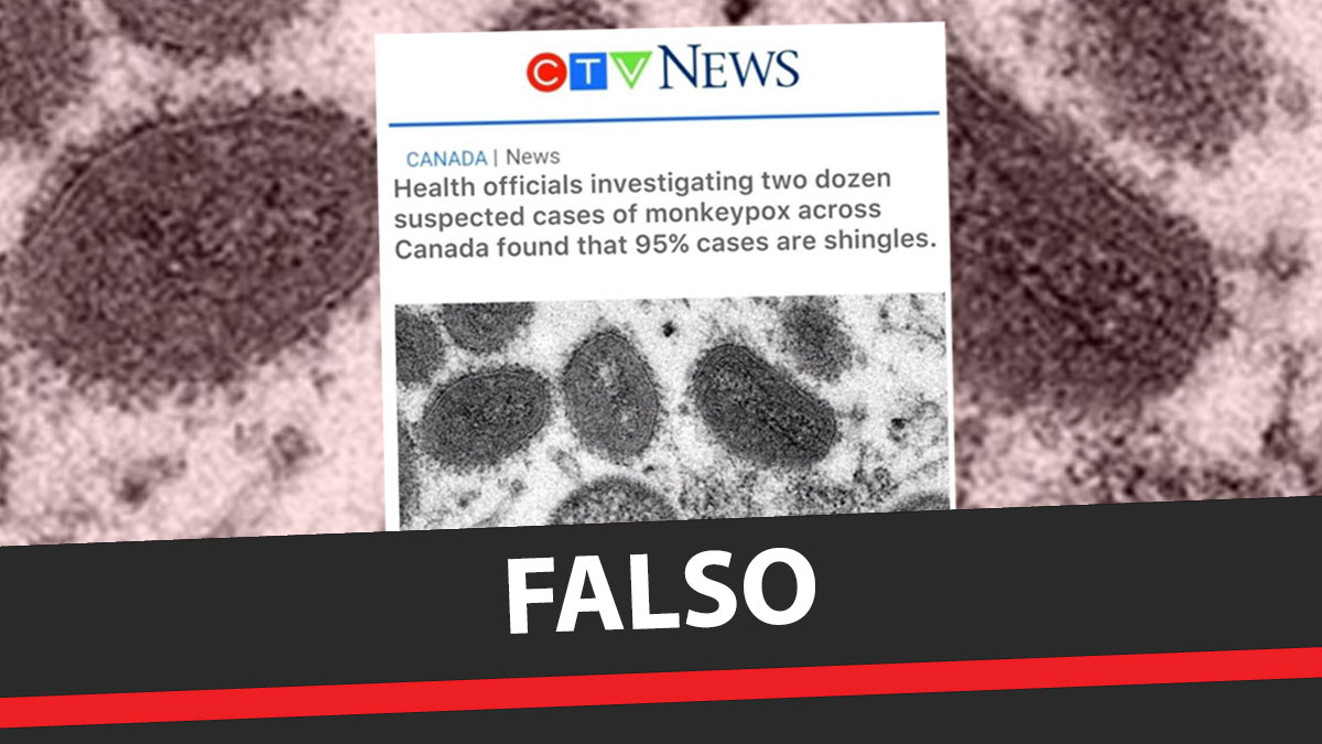 No!  95% of monkeypox infections in Canada are not single and are not linked to the Govt-19 vaccine