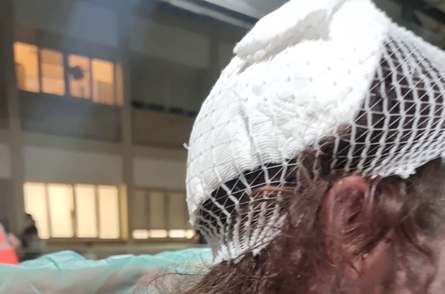 «Gli hanno spaccato la testa…», lo shock subito dopo l’aggressione omofoba a Bari. A Napoli altri due casi dopo il Pride – Il video