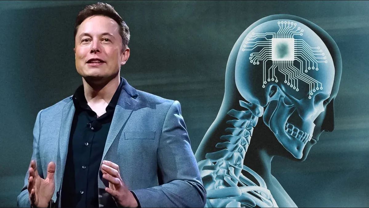 Neuralink, ok ai testi clinici sugli esseri umani per i chip di Elon Musk -  Open