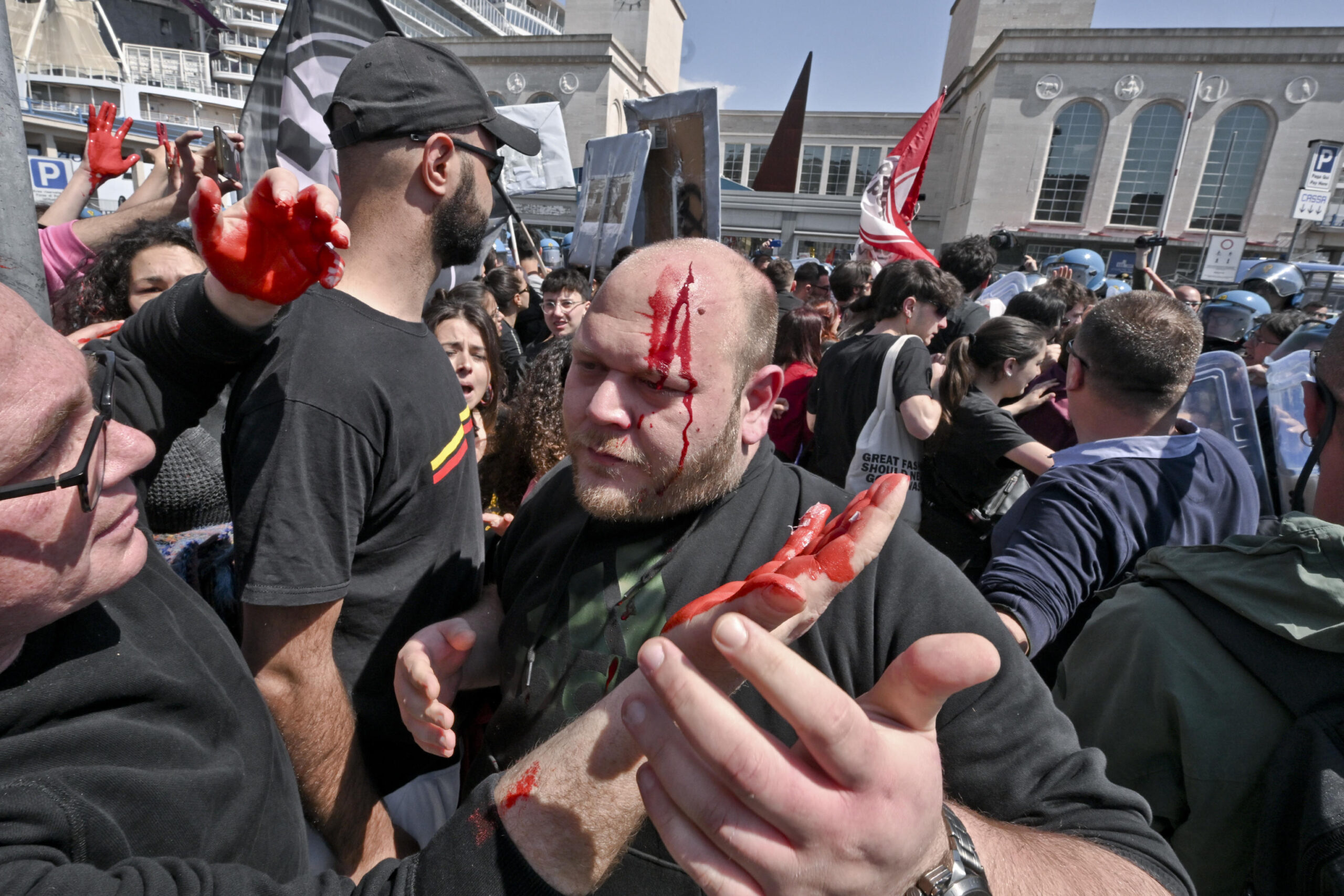 Un manifestante ferito durante i tafferugli in occasione dell'arrivo del ministro dell'Interno, Matteo Piantedosi al forum sui beni confiscati in corso alla Stazione Marittima di Napoli, 21 aprile 2023. ANSA/CIRO FUSCO