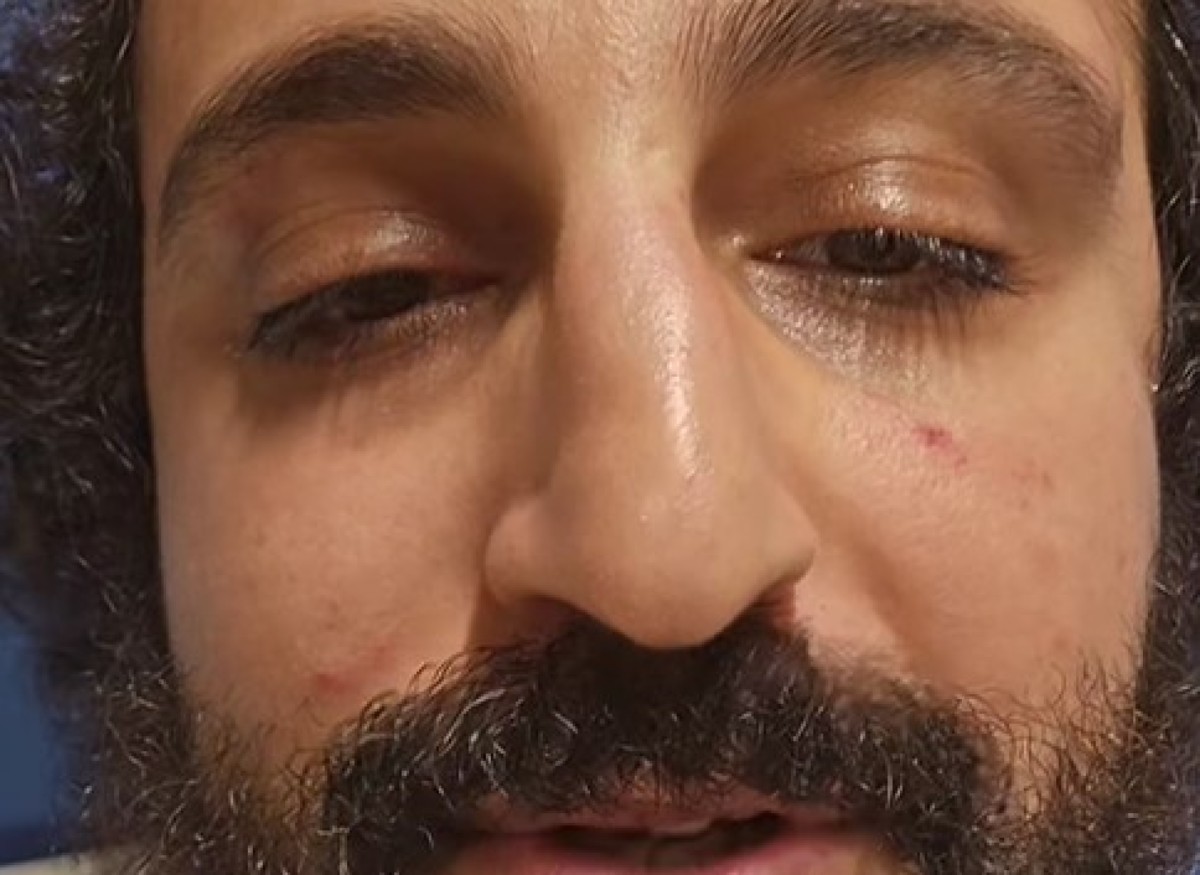 Roma, aggredito il divulgatore e influencer Karem Rohana insieme alla redattrice di Servizio Pubblico Benedetta Sabene – Il video