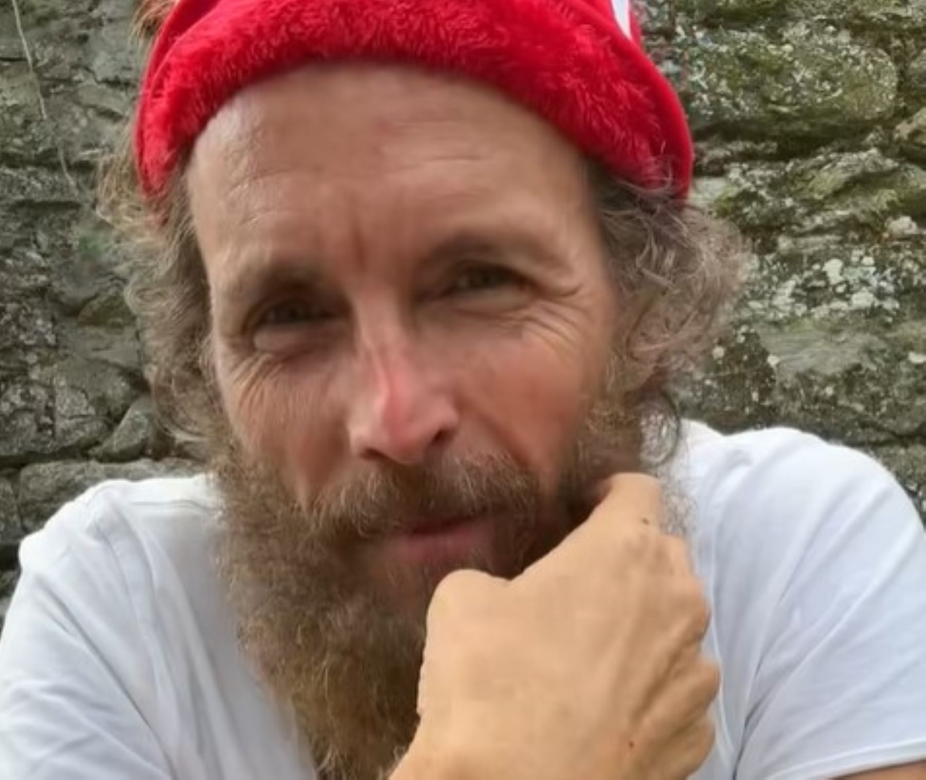 Lo sfogo di Jovanotti: «Non cammino ancora senza stampelle, ho fatto un casino» – Il video