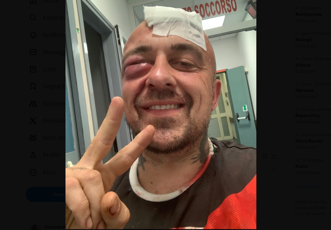 chef rubio massacrato botte pronto soccorso