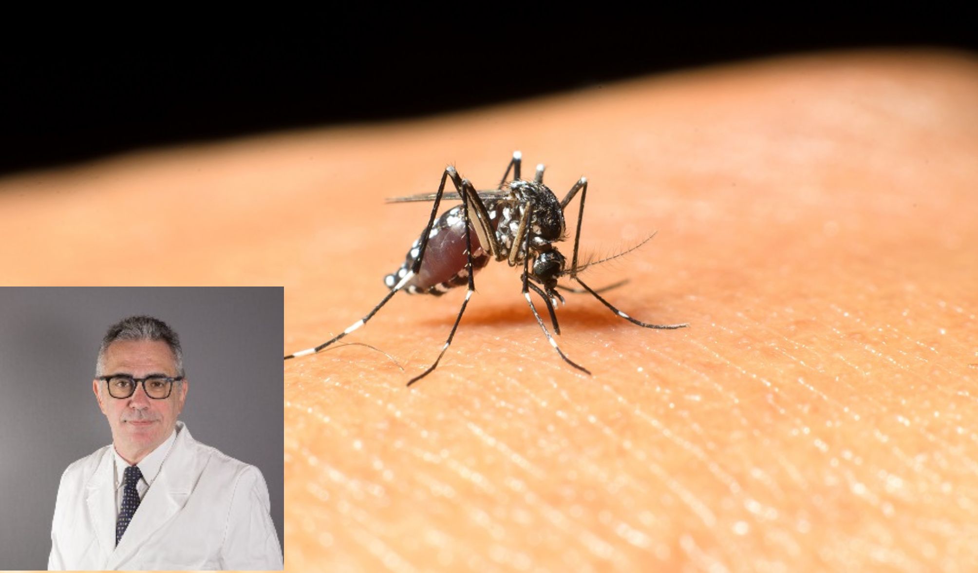 pregliasco zanzara west nile