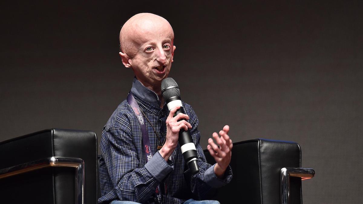 sammy basso morte eta malattia progeria