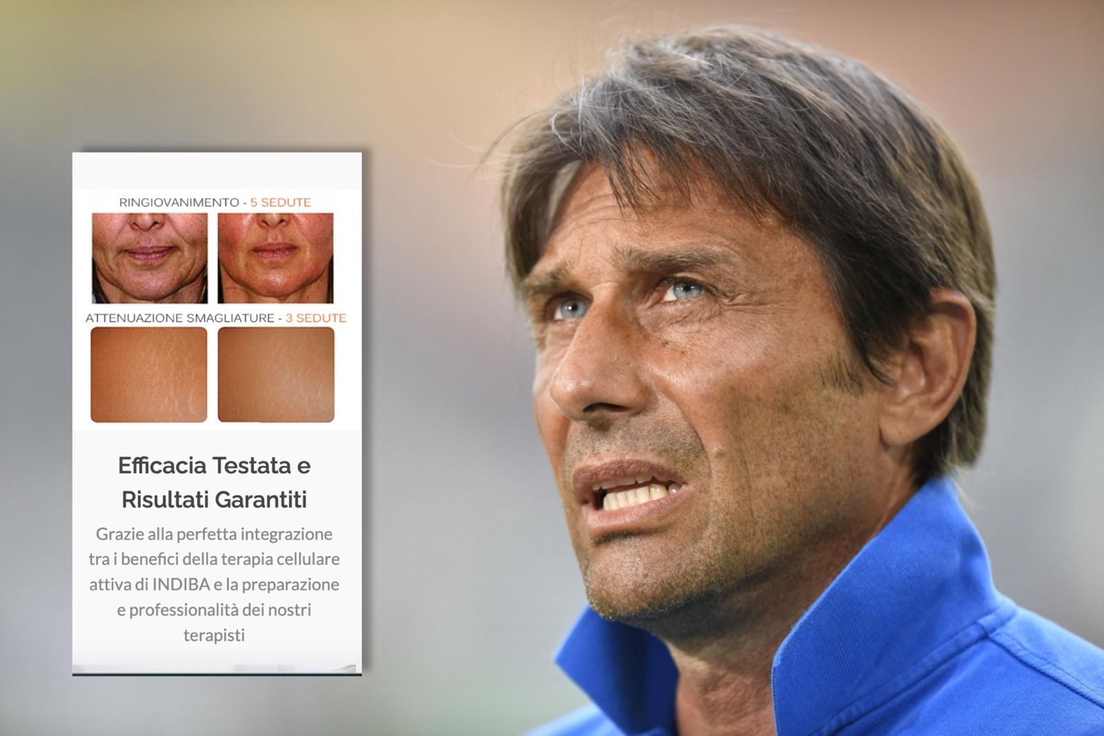 Antonio Conte e la fisioestetica