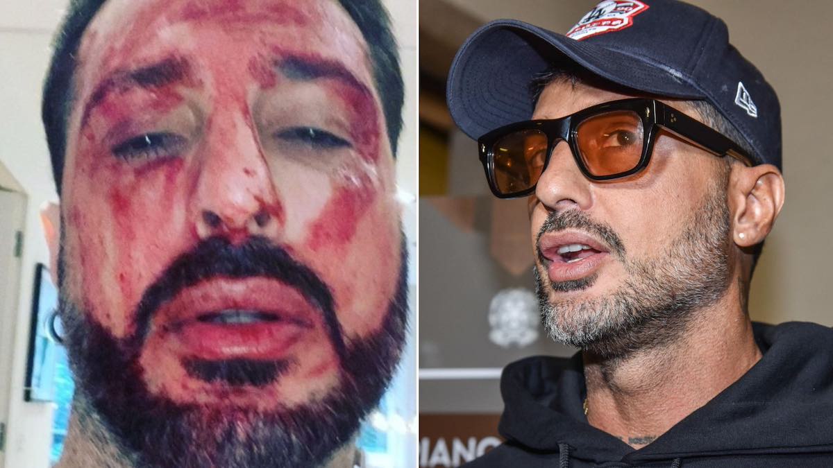 corona fabrizio arresto sangue multa diffamazione