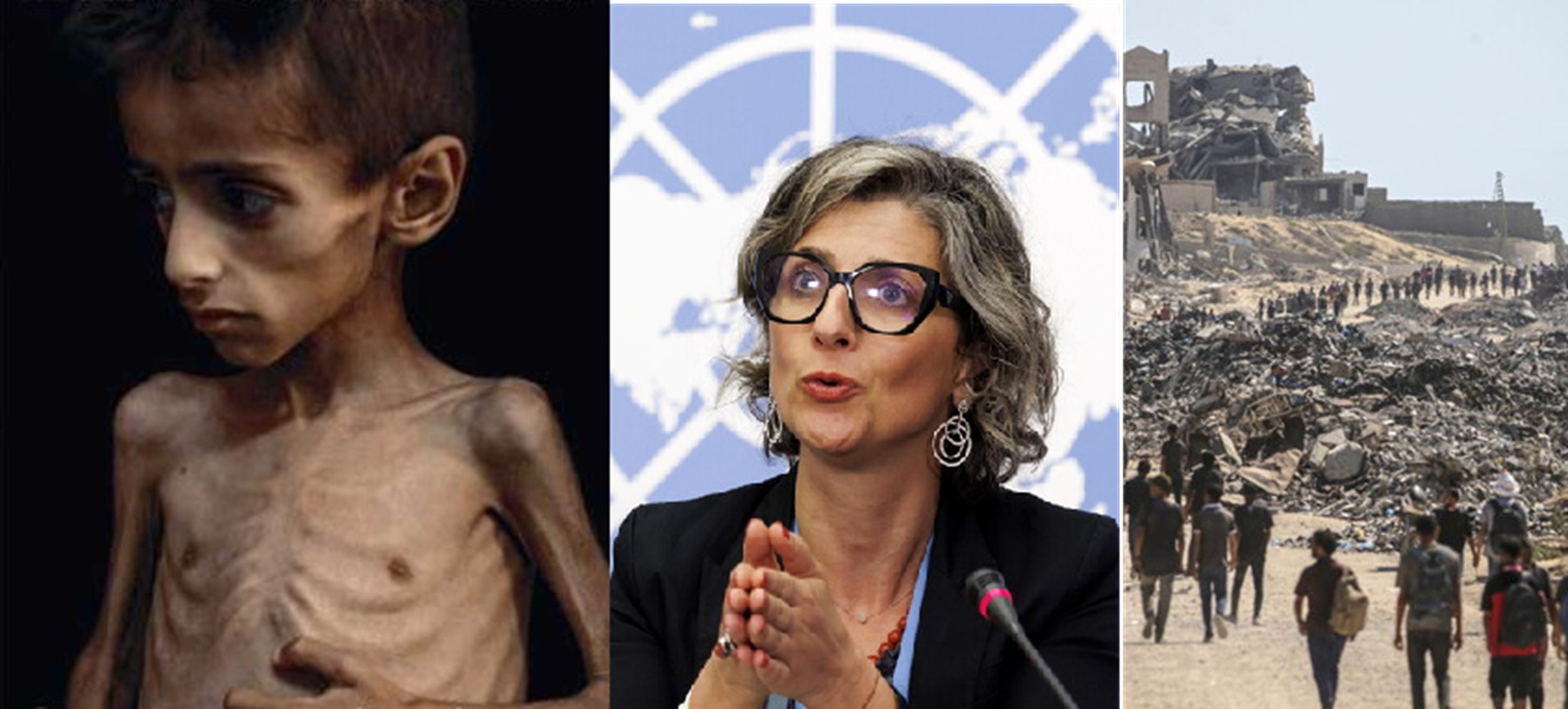 francesca albanese gaza israele bambini fame