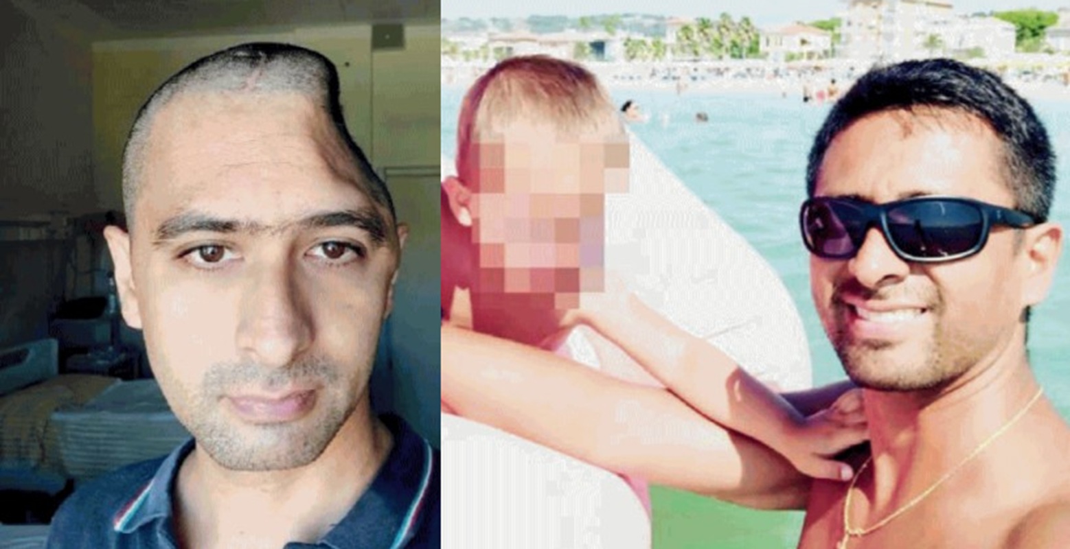 carlo perticarini pezzo di testa