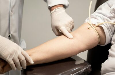 sviene-donazione-sangue-perde-occhio-risarcimento