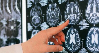 cervello-gennaio-buoni-propositi