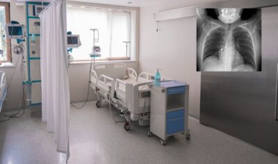 reggio calabria cacciavite incastrato