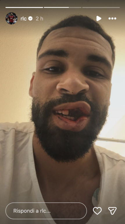 Ruben Loftus-Cheek senza denti