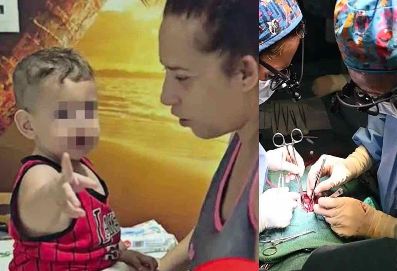 cuore bruciato bambino napoli trapianto perché