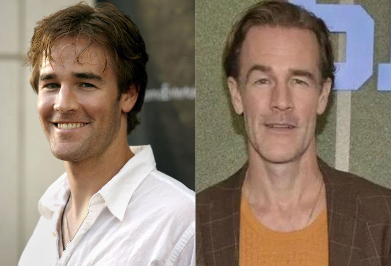 James Van Der Beek