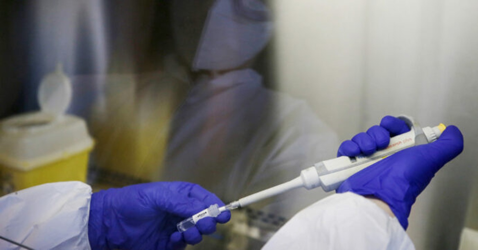 epatite a roma lazio casi sintomi vademecum