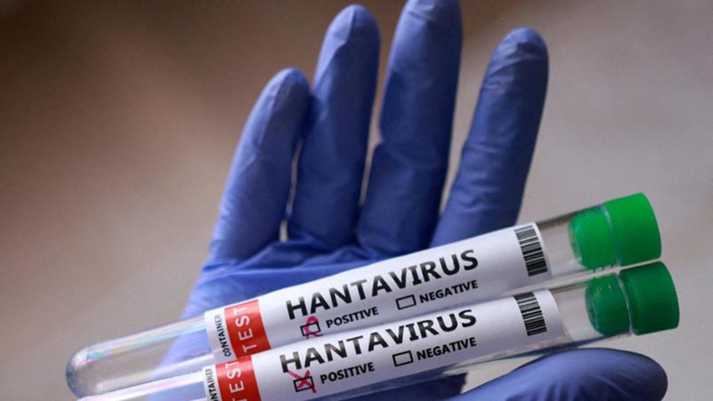 hantavirus vaccino esiste rna
