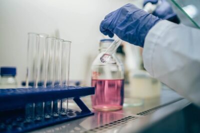 ricerca scientifica hantavirus