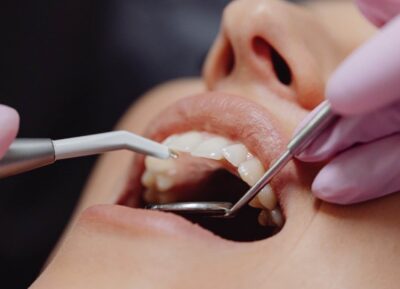 La ricerca punta sul far ricrescere i denti