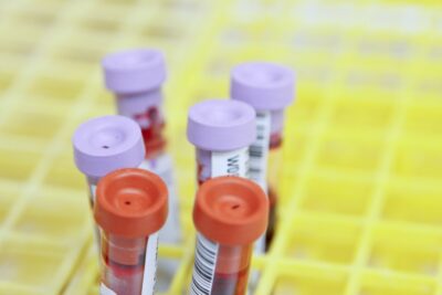 distrugge analisi sangue
