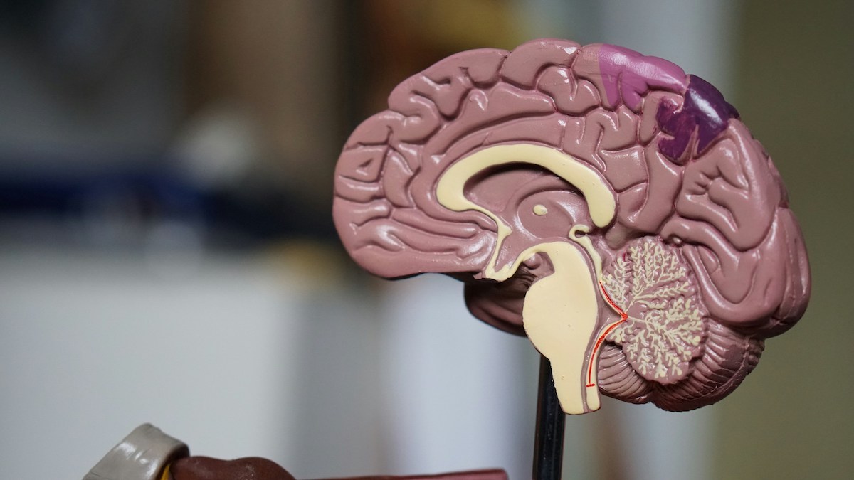 alzheimer analisi sangue diagnosi