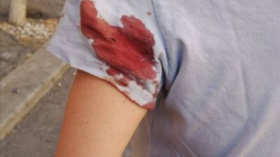 Una donna è stata ferita da un colpo mentre passeggiava vicino al Vaticano