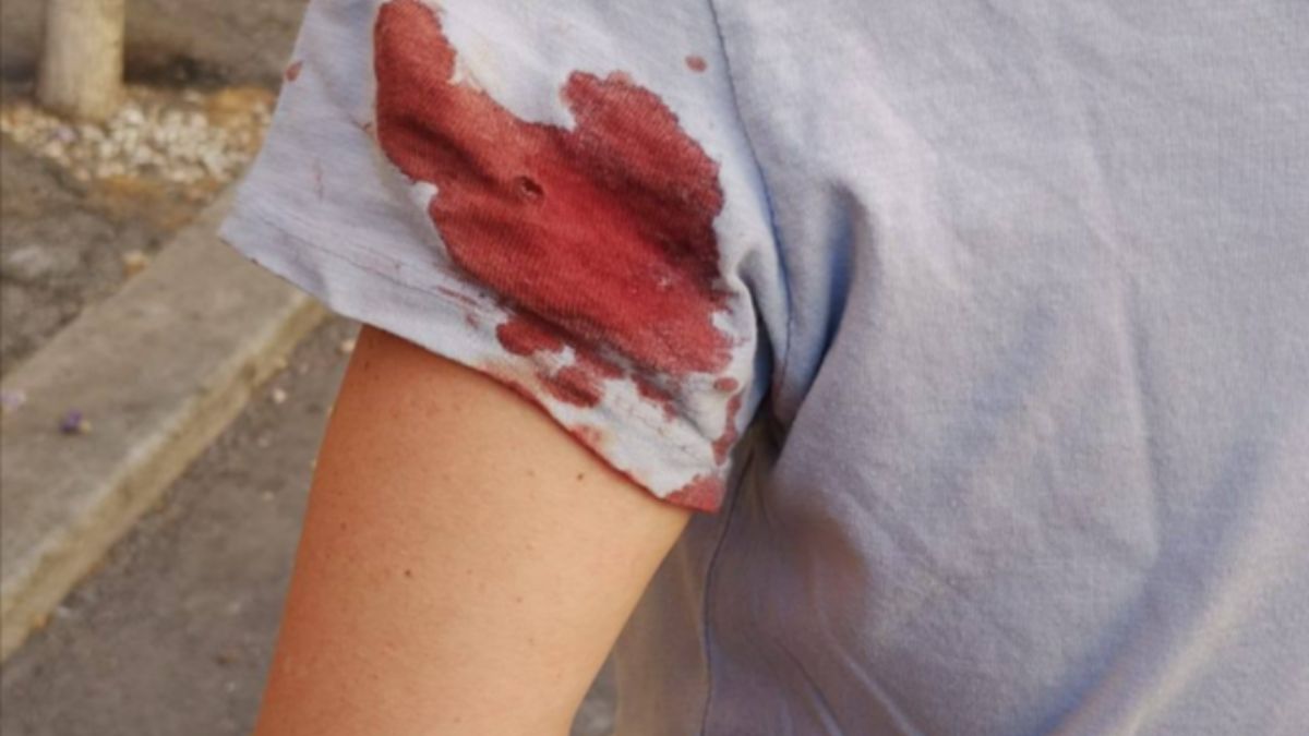 Una donna è stata ferita da un colpo mentre passeggiava vicino al Vaticano