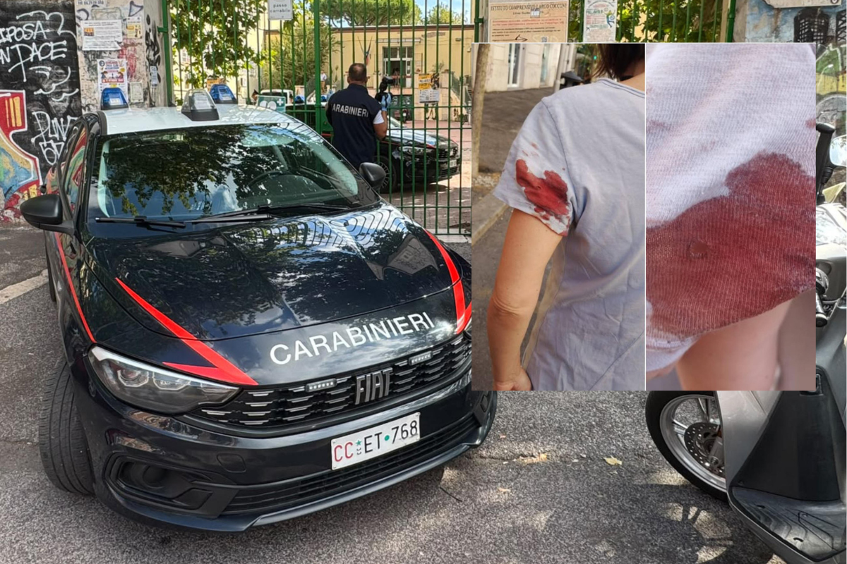 Parla la donna ferita dal cecchino di Roma