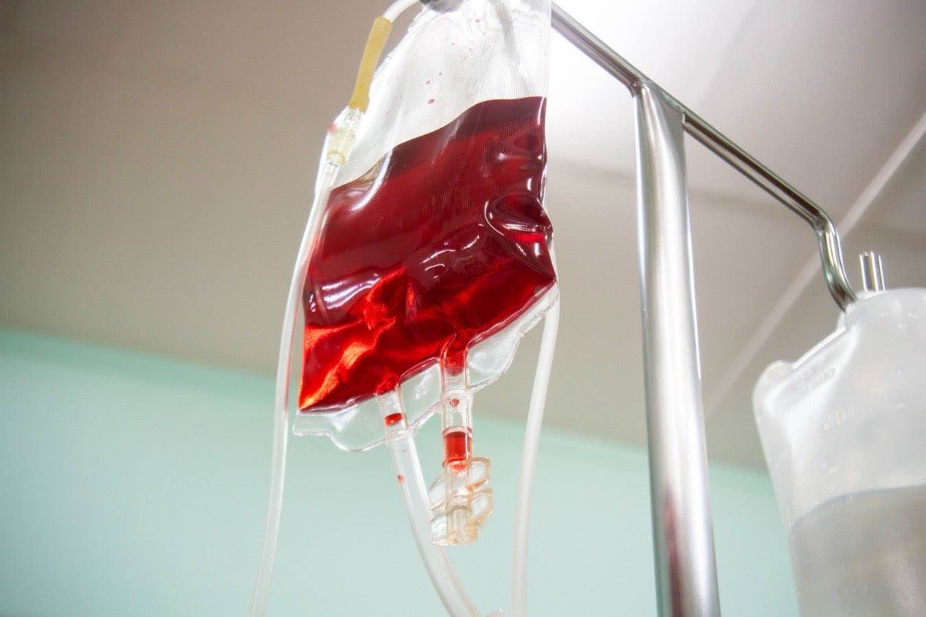 trasfusione sangue